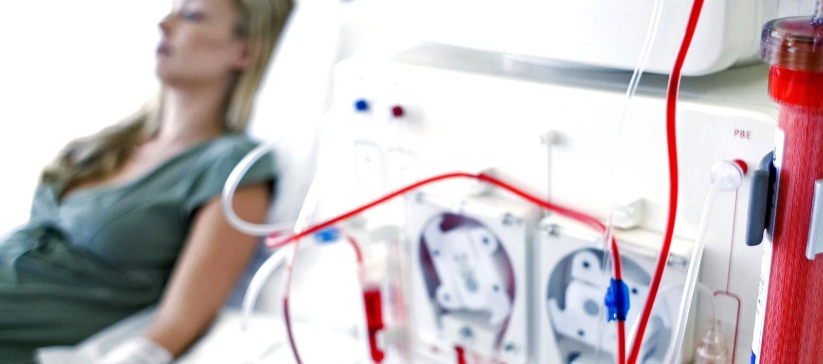 Medical illustration of kidneys